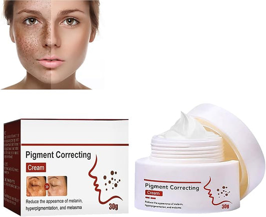 Eelhoe™ Pigment Correcting Cream-لإزالة البقع الداكنة والتصبغات