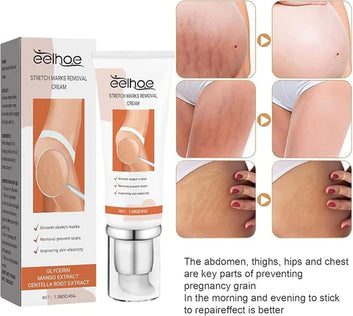 Eelhoe™ Restore & Glow Stretch Mark & Scar Cream-كريم ترميم الجلد الطبيعي